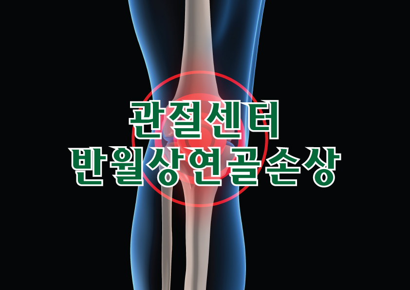 관절센터 - 발월상연골손상
