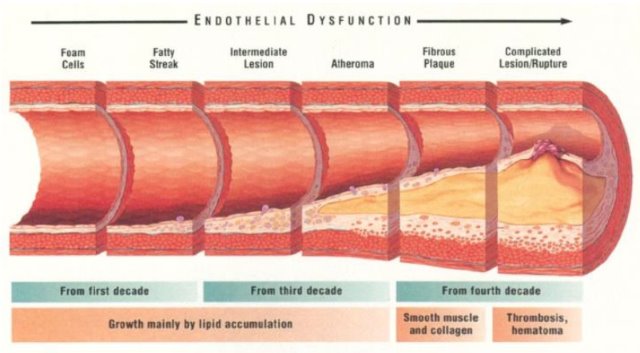 endothelial-dysfunction-lg[1].jpg